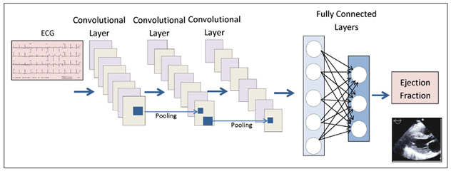 Convoluted neural network