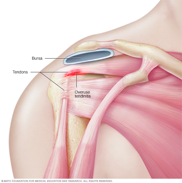 Tendons in shoulder