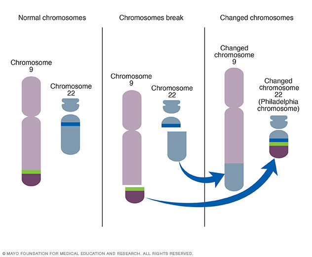 Creation of Philadelphia chromosome