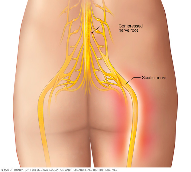 Sciatic nerve 