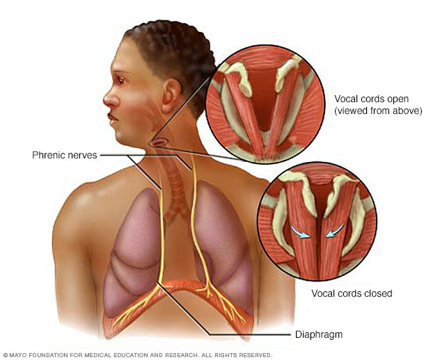 What causes hiccups