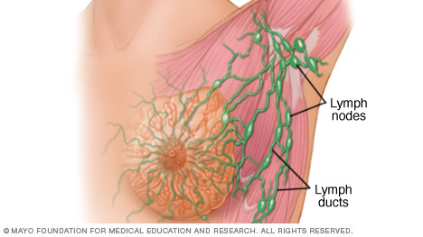 العُقَد والقنوات اللمفية في الثدي