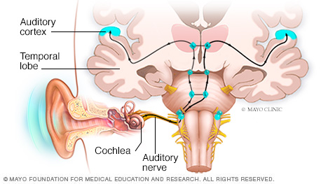 How electrical impulses travel to the brain