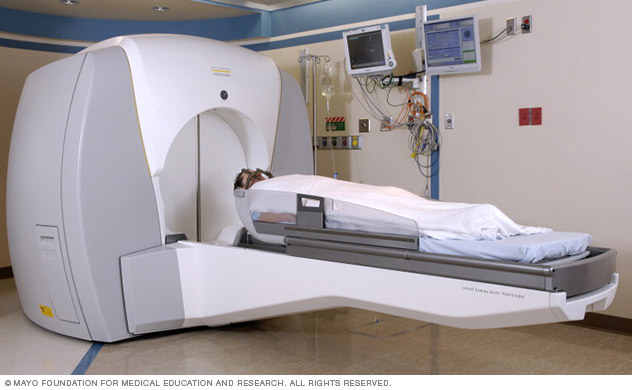 A patient undergoing stereotactic radiosurgery.