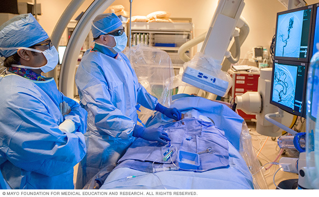 Mayo Clinic surgeons performing an endovascular procedure for brain aneurysm.