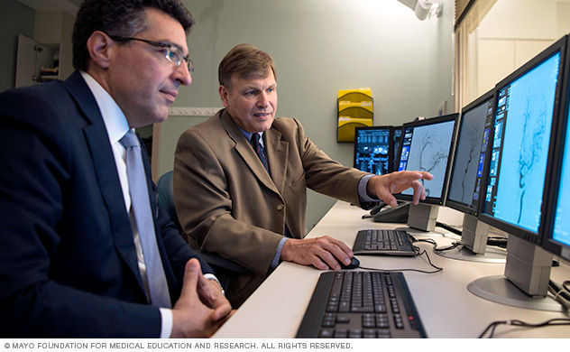 Mayo Clinic specialists confer on aspects of dural arteriovenous fistula care.