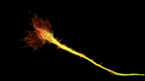 Contact adhesions in the nerve growth cone (paxillin in red, microtubules in green)