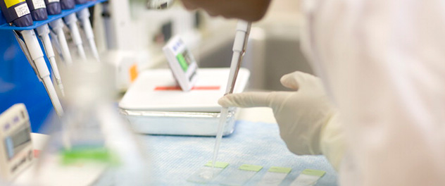 Photograph showing the hands of a researcher working in the lab in the Mayo Clinic Ovarian Cancer SPORE