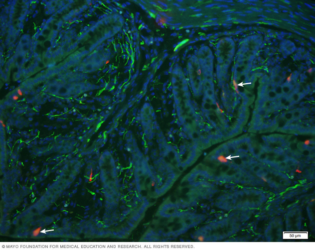 Microscopy image from Dr. Kashyap's Gut Microbiome Lab of enterochromaffin cells in the colonic mucosa