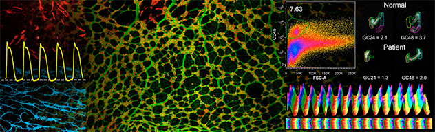 Multipaneled image demonstrating cellular defects of the GI tract, including ion channels, electrical activity, colonic transit and gastroparesis.