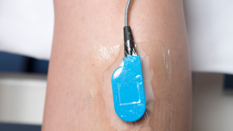 Picture of a surface EMG sensor taped over the skin to record muscle activity in the Motion Analysis Lab.