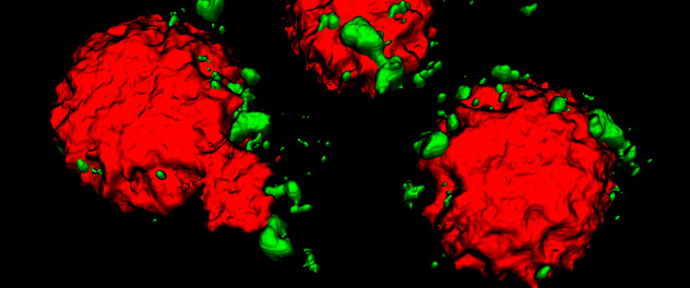 Super-resolution microscopy of damaged mitochondria next to Lewy bodies