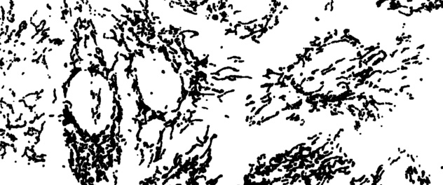 Microscopy showing mitochondrial networks in human cells