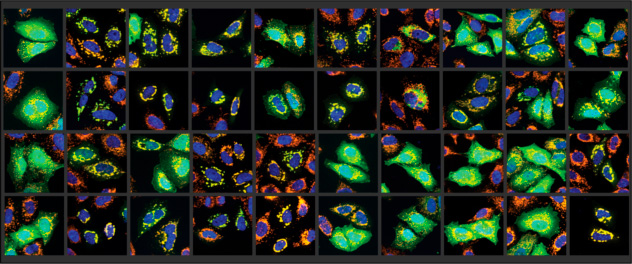 Microscopy of different Parkinson's disease-associated PRKN mutants at basal conditions and over time upon treatment with mitochondrial stressor presented in grid form