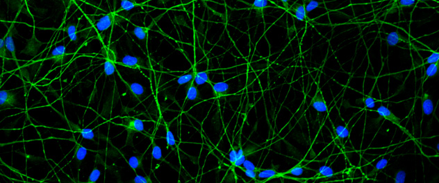 Microscopy shows neuronal cell model to study Parkinson's disease.