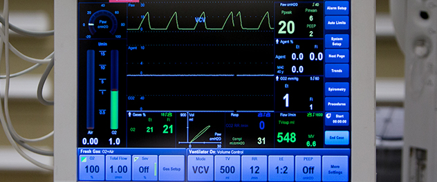 The Anesthesia Outcomes Lab at Mayo Clinic investigates the effects of anesthesia.