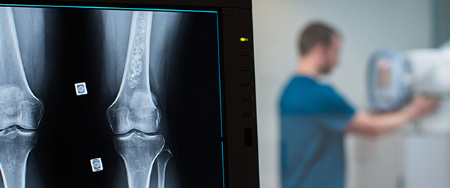 Lab imaging technician viewing a knee X-ray