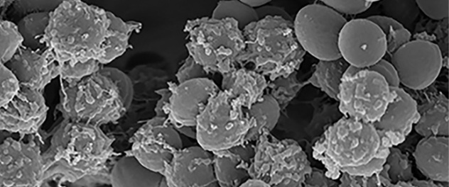 Image of an electron micrograph