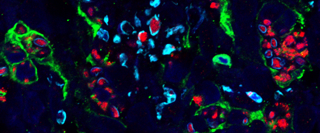 Spinal nerves [red] grow through scaffolding supported by cells [green] and myelin insulation [blue] after spinal cord injury.