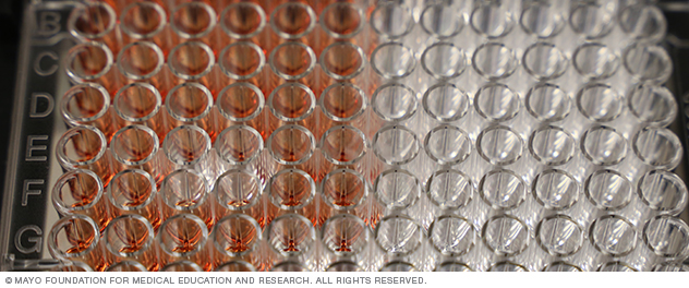 Dr. Choi's lab carries out translational and clinical research to identify and validate biomarkers associated with pharmacotherapy.