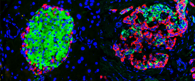 Dr. Matveyenko's Islet Regeneration Lab at Mayo Clinic is developing novel therapeutic and preventive approaches to restore and regenerate pancreatic beta cells as a critical step in combating diabetes mellitus, a disease that affects hundreds of millions of people worldwide.