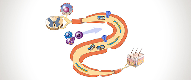 Clinical trials in neuromuscular diseases