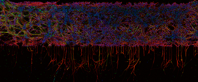 Dr. Staff's Translational Neuromuscular Disease Research Laboratory at Mayo Clinic uses human iPSC-derived sensory neurons to study mechanisms of chemotherapy-induced peripheral neuropathy.