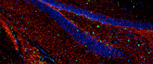 Microscopy of myelin sheath in hippocampus