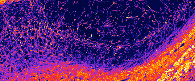 Colorful heatmap of brain hippocampus