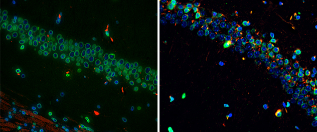 Microscopy of composite