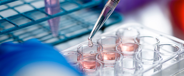 Pipette dropping liquid into test tubes containing samples