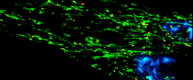 Changes in mitochondria (green), mtDNA (red) and nucleus (blue) are visualized by super-resolution microscopy in the Cell and Molecular Aging Lab led by Joao Passos, Ph.D.