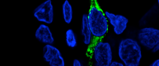 Dr. Acosta's Precision Medicine for Obesity Lab at Mayo Clinic uses immunofluorescence confocal microscopy to show a glucagon-like peptide-1 (GLP-1;Green) producing enteroendocrine L-cell within the human colonic epithelium.