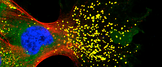 Image showing metabolic changes that fuel metastasis in the Razidlo Cell Biology of Metastasis Lab