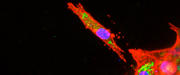 Image showing a model of cancer metastasis in the Razidlo Cell Biology of Metastasis Lab