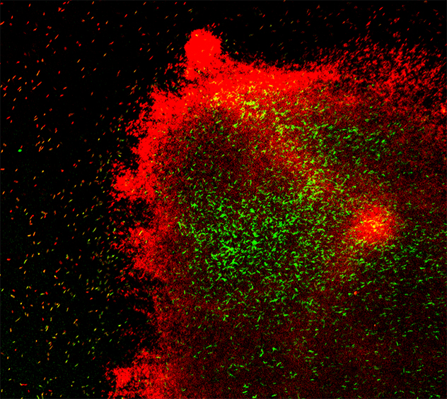 Microscopy image of C. difficile biofilm from Dr. Kashyap's Gut Microbiome Lab at Mayo Clinic