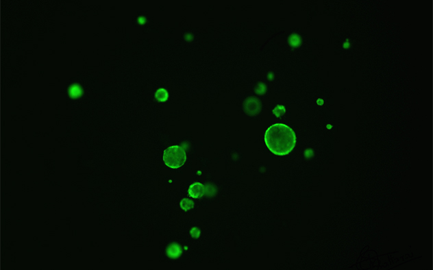 Microscopy image from the Mayo Clinic Gut Microbiome Lab of murine colonoids