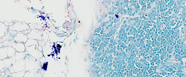 Microscopic mast cell degranulation in the heart in the Fairweather lab