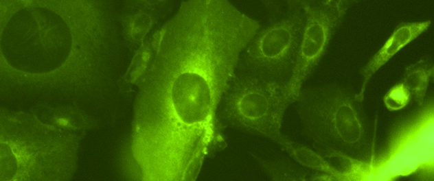 Image taken from microscope in the Castro Cancer Research and Cellular Therapies Lab