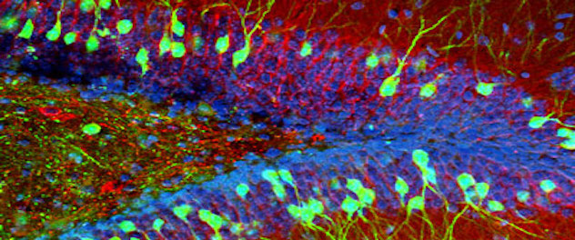 Microscopy of hippocampal neurons