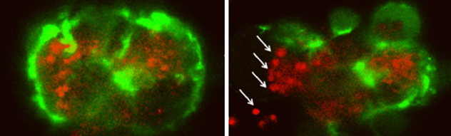 The Pancreatitis and Autoimmune Disorders Lab at Mayo Clinic show zymogen granules (red) releasing basolaterally from the acinus after exposure to a stimulus causing pancreatitis.