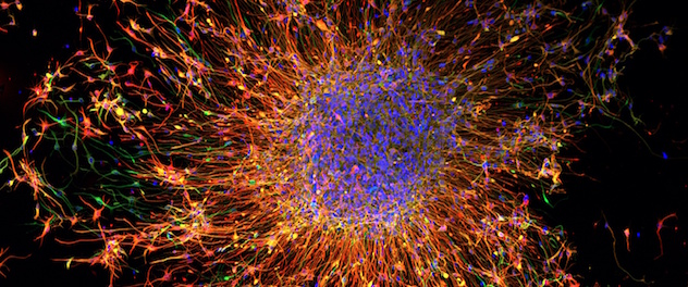 Immunofluorescence image from primary-derived glioblastoma cells shows colors representing different proteins.