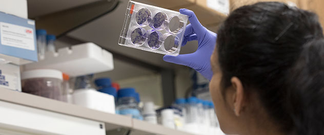 Photo of a researcher studying cells in the Stem Cell and Cancer Biology Lab at Mayo Clinic