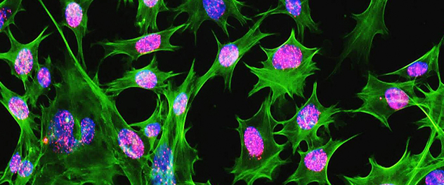 The Bone Injury and Repair Laboratory led by Abhishek Chandra, Ph.D., is identifying novel pathways and exploring sustainable treatment options for osteoporosis by targeting cellular processes.