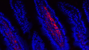 The Early Life Immune Responses Lab of Kathryn A. Knoop, Ph.D., at Mayo Clinic studies how to prevent antigen translocation of maternal components in breast milk.