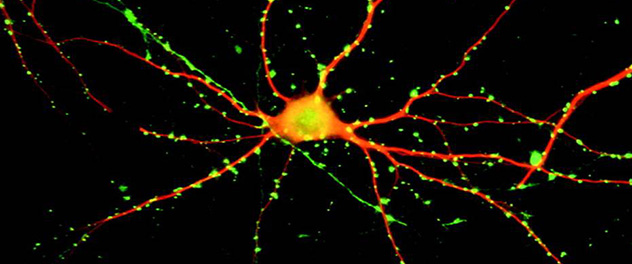 Neuron microscopy