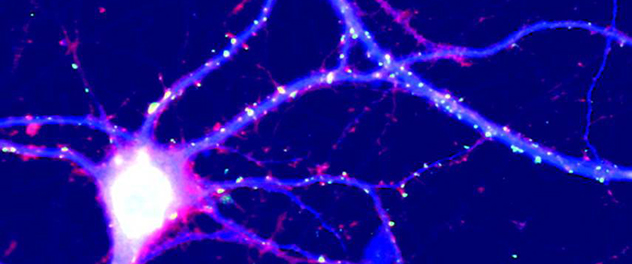 Neuron microscopy