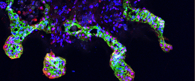 Microscopy showing lung organoid formed from human bronchial epithelium, fibroblasts and endothelium