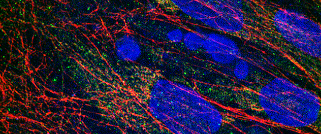 Microscopy showing human lung fibroblasts depositing collagen into the extracellular matrix