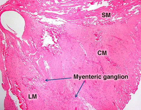 Resected tissue sample (H&E stain) from a gastric muscle biopsy showing muscularis propria and myenteric ganglia